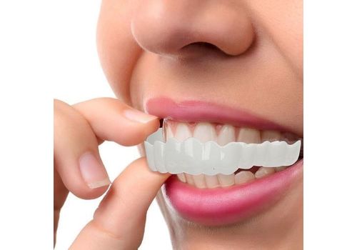 Snap on Smile parfait sourire blanchiment des dents au meilleur prix au Maroc