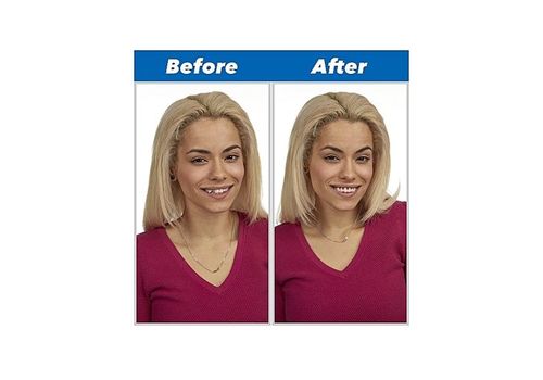 Prothèse Ajustement Flex Cosmétique Dents au meilleur prix au Maroc