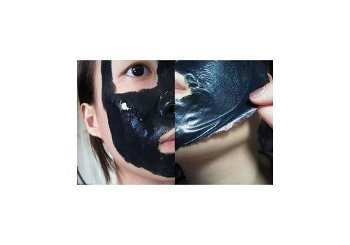 Masque Noir carbone pour éliminer l'acné et les points noirs au meilleur prix au Maroc
