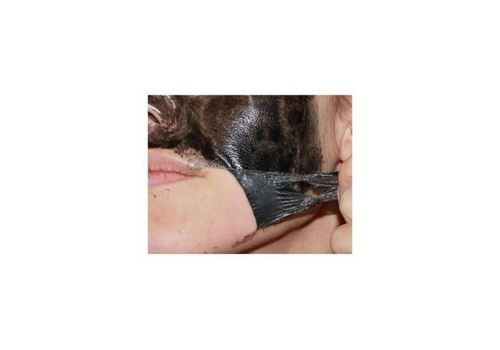 Masque Noir carbone pour éliminer l'acné et les points noirs au meilleur prix au Maroc