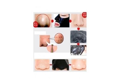 Masque Noir carbone pour éliminer l'acné et les points noirs au meilleur prix au Maroc