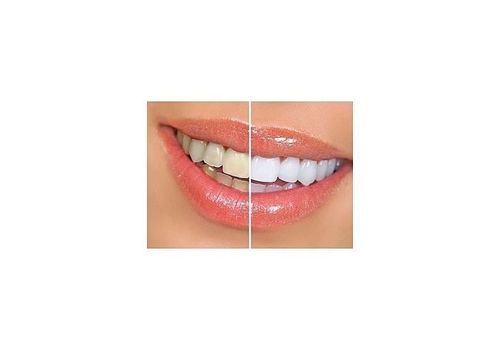 Stylo Blanchiment des dents au meilleur prix au Maroc