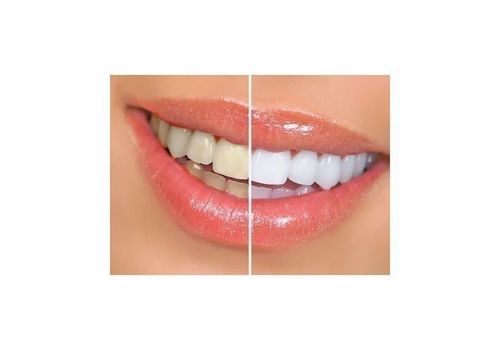 Stylo Blanchiment des dents instantané - Dazzling White - Stylo Applicateur au meilleur prix au Maroc