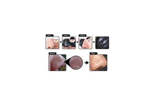 Black Masque Anti Acné 100% Efficace au meilleur prix au Maroc