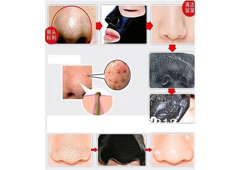 Black Mask pour Homme & Femme, Masque Noir unisex soin du visage mask anti acné et point noir au meilleur prix au Maroc