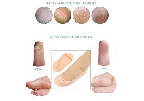 Chaussette en Silicone anti-fissure au meilleur prix au Maroc