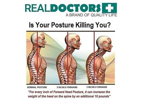 ORIGINAL Correcteur posture dos et epaules au meilleur prix au Maroc