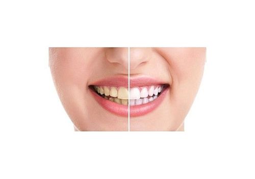 20 Minute Dental White système au meilleur prix au Maroc